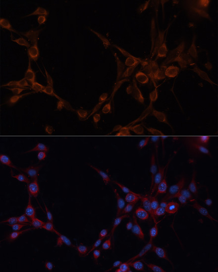 Immunofluorescence - ALDH6A1 Polyclonal Antibody 