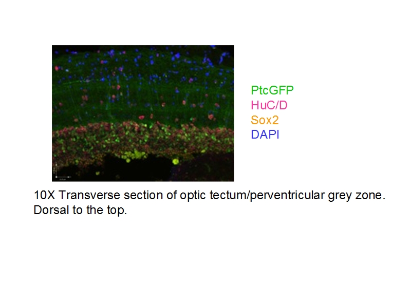 IF result of anti-SOX2 (Catalog No:115515) whith the grey zone of zebrafish by Dr.Caroline.
