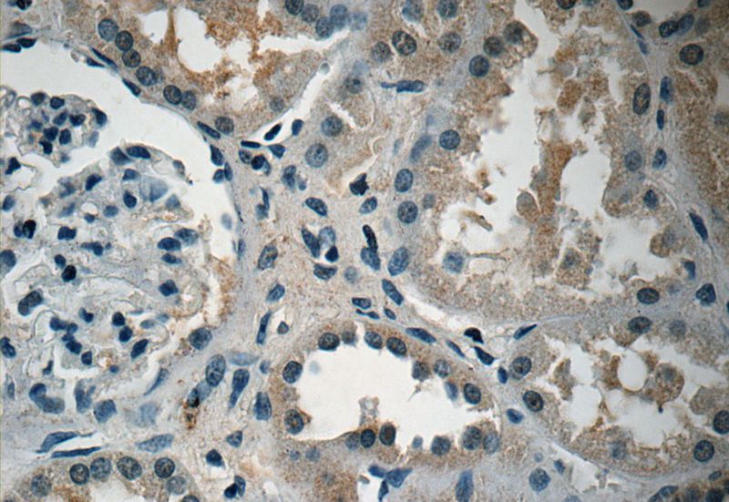 Immunohistochemistry of paraffin-embedded human kidney tissue slide using Catalog No:107893(ADM Antibody) at dilution of 1:50 (under 40x lens)