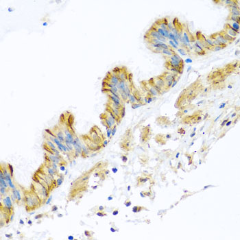 Immunohistochemistry - PCDHA12 Polyclonal Antibody 