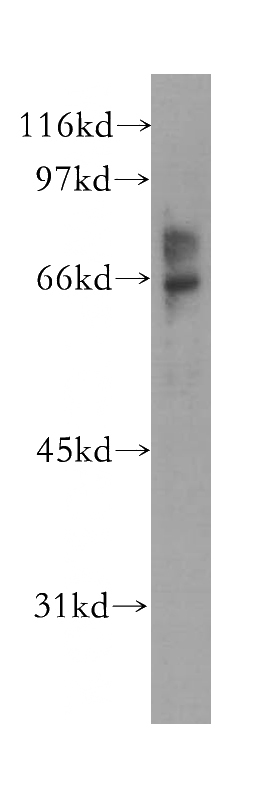A375 cells were subjected to SDS PAGE followed by western blot with Catalog No:110236(EME1 antibody) at dilution of 1:500