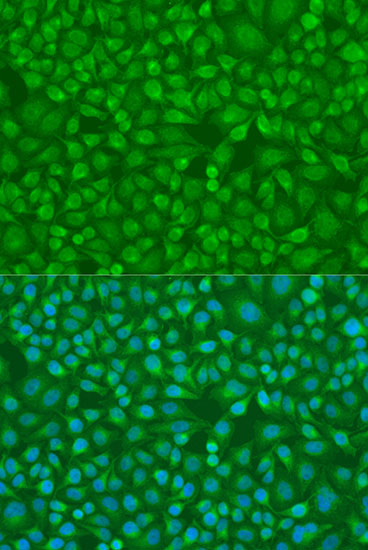 Immunofluorescence - IRF7 Polyclonal Antibody 