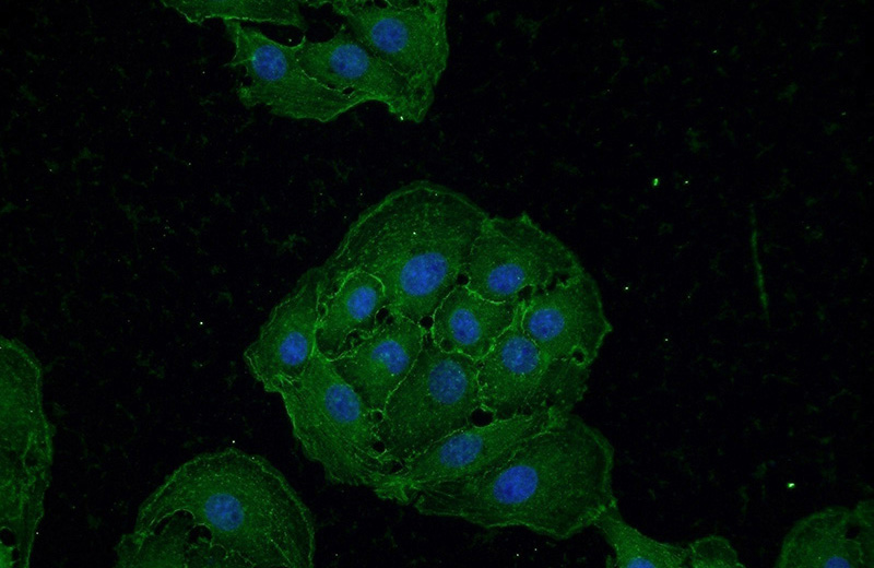 Immunofluorescent analysis of SH-SY5Y cells using Catalog No:110018(Drebrin Antibody) at dilution of 1:50 and Alexa Fluor 488-congugated AffiniPure Goat Anti-Rabbit IgG(H+L)
