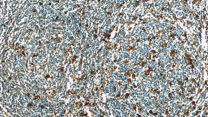 Immunohistochemical of paraffin-embedded human tonsillitis using Catalog No:114182(Pre-IL18 antibody) at dilution of 1:50 (under 10x lens)
