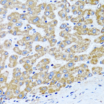 Immunohistochemistry - COL10A1 Polyclonal Antibody 
