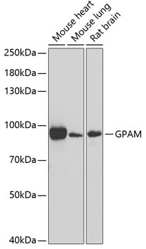 Western blot - GPAM Polyclonal Antibody 