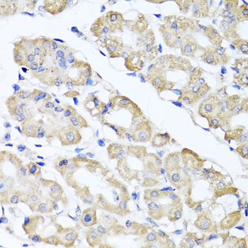 Immunohistochemistry - SPICE1 Polyclonal Antibody 