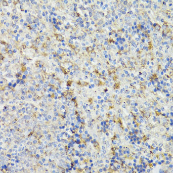 Immunohistochemistry - CHGA Polyclonal Antibody 