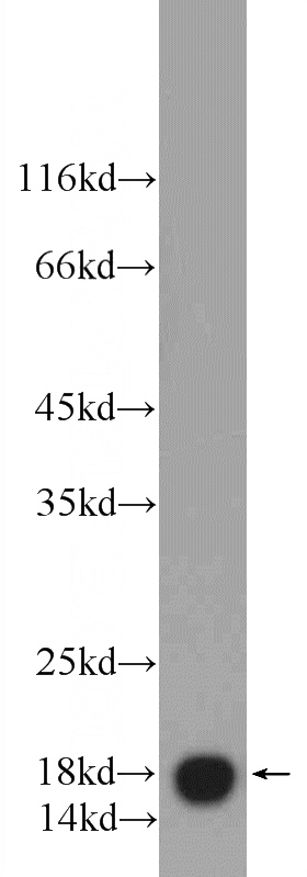 mouse testis tissue were subjected to SDS PAGE followed by western blot with Catalog No:116707(VAMP4 Antibody) at dilution of 1:600