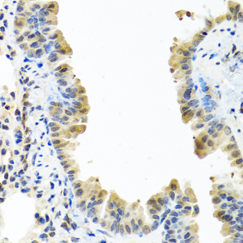 Immunohistochemistry - ARSF Polyclonal Antibody 