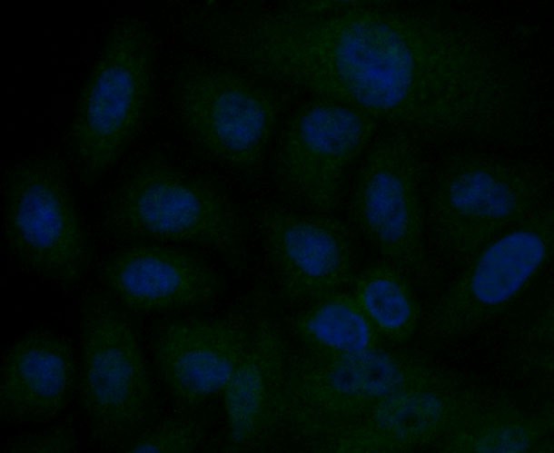 Fig2: ICC staining ITPR2 in HepG2 cells (green). The nuclear counter stain is DAPI (blue). Cells were fixed in paraformaldehyde, permeabilised with 0.25% Triton X100/PBS.