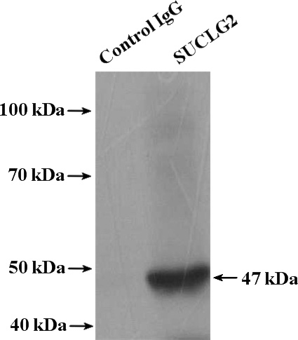 IP Result of anti-SUCLG2 (IP:Catalog No:115820, 4ug; Detection:Catalog No:115820 1:600) with mouse kidney tissue lysate 4800ug.