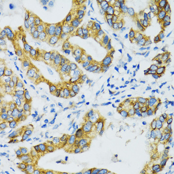 Immunohistochemistry - SLC5A1 Polyclonal Antibody 