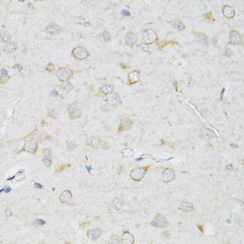 Immunohistochemistry - SLC2A13 Polyclonal Antibody 