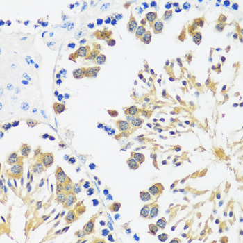 Immunohistochemistry - CALM3 Polyclonal Antibody 