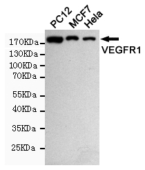Western blot analysis of extract from Hela,MCF7 and PC12 cells using VEGFR1 rabbit pAb (dilution 1:1000).Predicted band size:180KDa.Observed band size:180KDa.