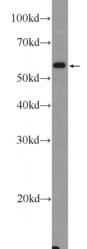 A431 cells were subjected to SDS PAGE followed by western blot with Catalog No:113935(PLAG1 Antibody) at dilution of 1:300