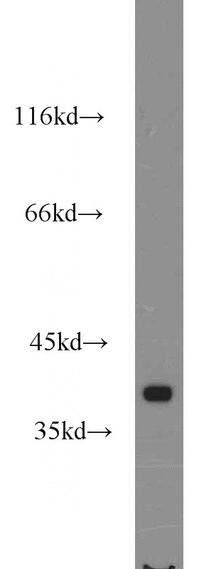 human brain tissue were subjected to SDS PAGE followed by western blot with Catalog No:114695(RIBC2 antibody) at dilution of 1:1000