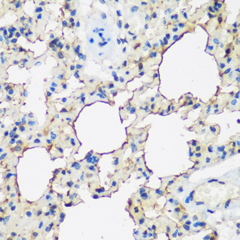 Immunohistochemistry - ALOX15 Polyclonal Antibody 