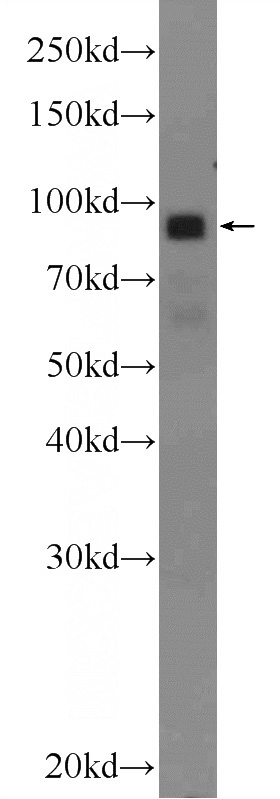 HeLa cells were subjected to SDS PAGE followed by western blot with Catalog No:109910(DGKB Antibody) at dilution of 1:1000