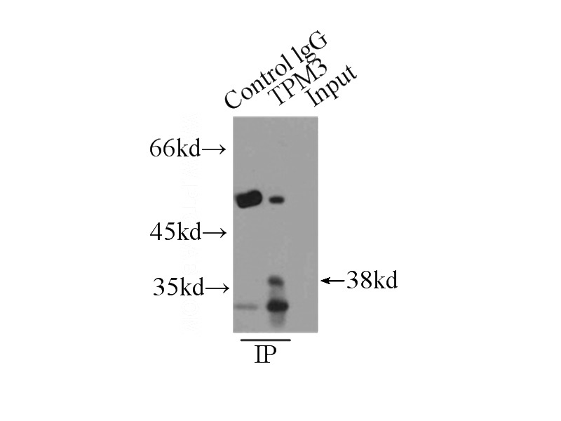 IP Result of anti-TPM3 (IP:Catalog No:116206, 4ug; Detection:Catalog No:116206 1:300) with HeLa cells lysate 2000ug.