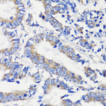 Immunohistochemistry - DEPDC6 Polyclonal Antibody 