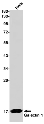 Western blot detection of Galectin 1 in Hela cell lysates using Galectin 1 Rabbit pAb(1:1000 diluted).Predicted band size:15kDa.Observed band size:15kDa.