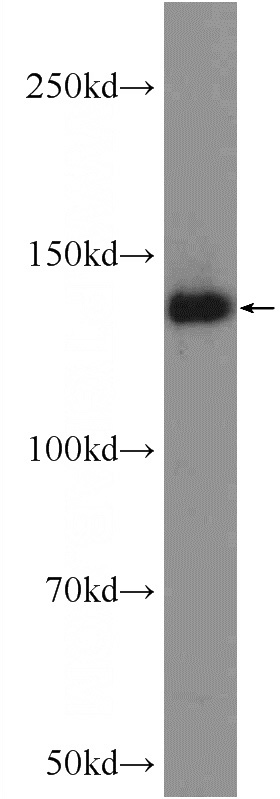 HeLa cells were subjected to SDS PAGE followed by western blot with Catalog No:116544(UBE4B Antibody) at dilution of 1:3000
