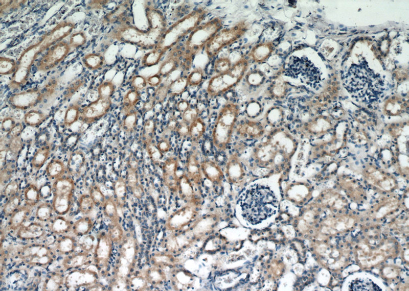 Immunohistochemical of paraffin-embedded human kidney using Catalog No:108370(BBS3 antibody) at dilution of 1:50 (under 10x lens)