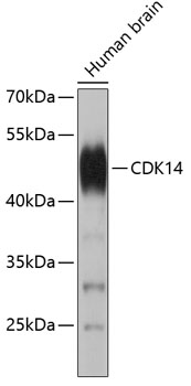 Western blot - CDK14 Polyclonal Antibody 