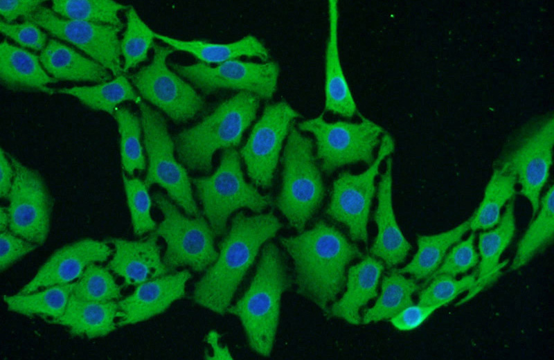Immunofluorescent analysis of SH-SY5Y cells using Catalog No:116408(TRPC5 Antibody) at dilution of 1:25 and Alexa Fluor 488-congugated AffiniPure Goat Anti-Rabbit IgG(H+L)
