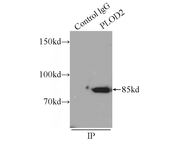 IP Result of anti-PLOD2 (IP:Catalog No:114005, 4ug; Detection:Catalog No:114005 1:500) with mouse testis tissue lysate 5000ug.