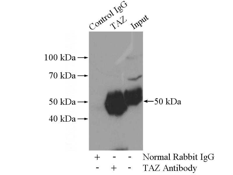 IP Result of anti-WWTR1,TAZ (IP:Catalog No:115860, 4ug; Detection:Catalog No:115860 1:300) with MDA-MB-453s cells lysate 2800ug.