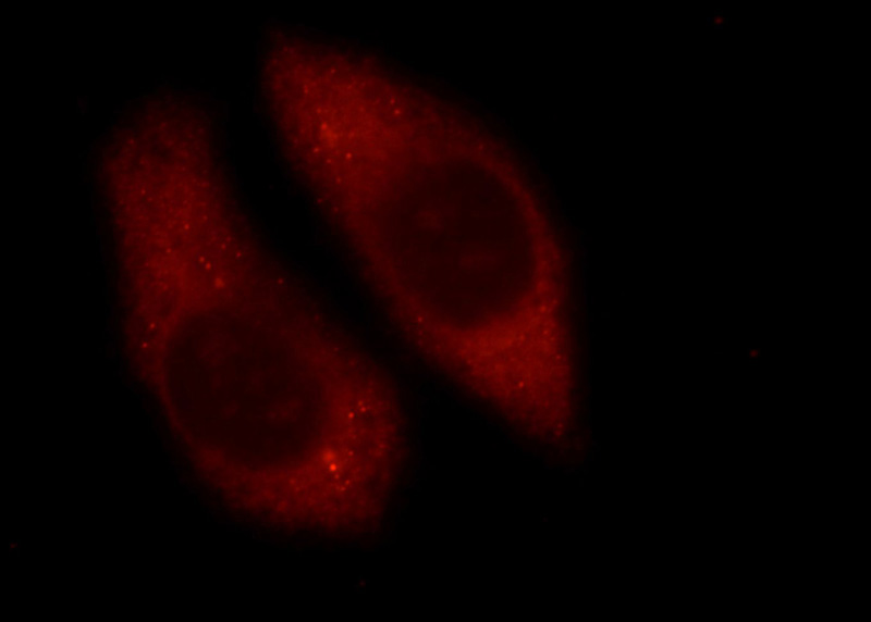 Immunofluorescent analysis of HepG2 cells using Catalog No:114443(RAB3C-specific Antibody) at dilution of 1:25 and Rhodamine-Goat anti-Rabbit IgG