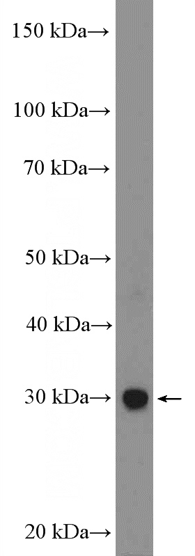 mouse brain tissue were subjected to SDS PAGE followed by western blot with Catalog No:110244(EMX1 Antibody) at dilution of 1:600
