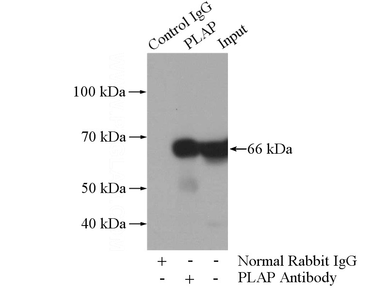 IP Result of anti-ALPP (IP:Catalog No:113939, 4ug; Detection:Catalog No:113939 1:700) with HepG2 cells lysate 1800ug.