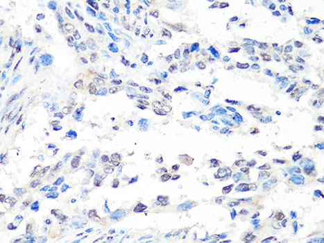 Immunohistochemistry - MTA2 Polyclonal Antibody 