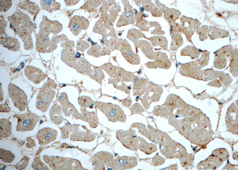 Immunohistochemistry of paraffin-embedded human heart slide using Catalog No:110061(RP11-529I10.4 Antibody) at dilution of 1:50