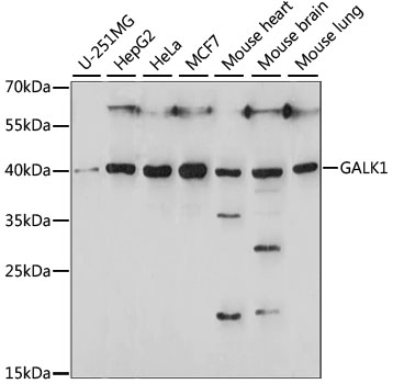 Western blot - GALK1 Polyclonal Antibody 