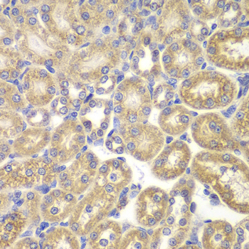 Immunohistochemistry - PSMD9 Polyclonal Antibody 