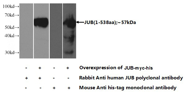 Transfected HEK-293 cells were subjected to SDS PAGE followed by western blot with Catalog No:107921(JUB Antibody) at dilution of 1:800
