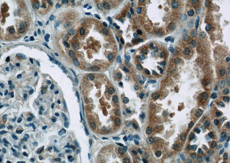 Immunohistochemistry of paraffin-embedded human kidney tissue slide using Catalog No:110177(EIF1B Antibody) at dilution of 1:50 (under 40x lens)