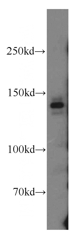 HeLa cells were subjected to SDS PAGE followed by western blot with Catalog No:109414(MET antibody) at dilution of 1:300