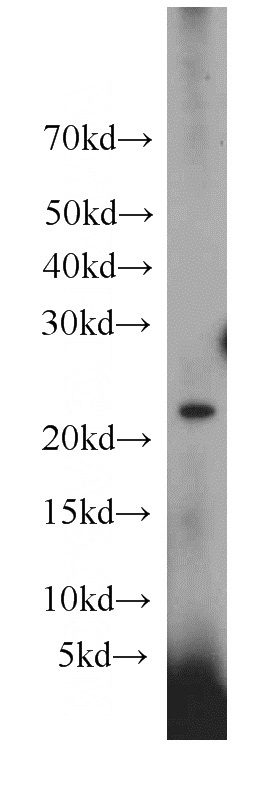 HeLa cells were subjected to SDS PAGE followed by western blot with Catalog No:116764(VMO1 antibody) at dilution of 1:300