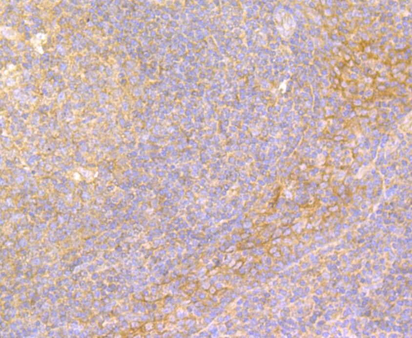 Fig3: Immunohistochemical analysis of paraffin-embedded human tonsil tissue using anti-IL-22 antibody. The section was pre-treated using heat mediated antigen retrieval with sodium citrate buffer (pH 6.0) for 20 minutes. The tissues were blocked in 5% BSA for 30 minutes at room temperature, washed with ddH2O and PBS, and then probed with the antibody at 1/200 dilution, for 30 minutes at room temperature and detected using an HRP conjugated compact polymer system. DAB was used as the chrogen. Counter stained with hematoxylin and mounted with DPX.
