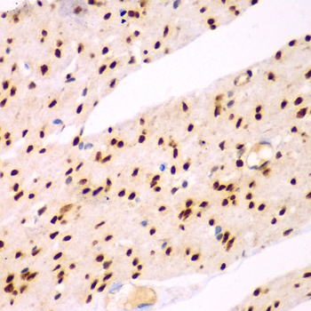 Immunohistochemistry - TEAD3 Polyclonal Antibody 