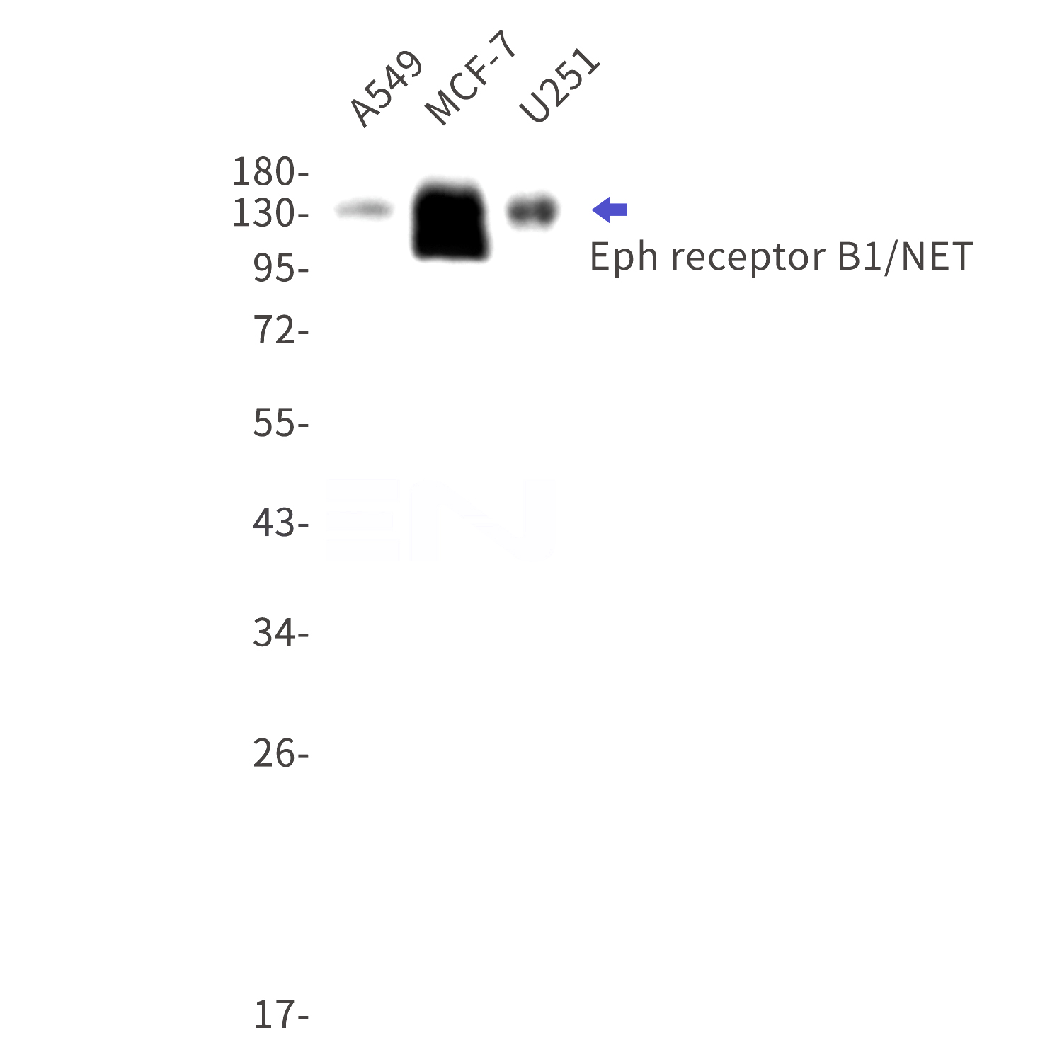 Western blot detection of Eph receptor B1/NET in A549,MCF-7,U251 cell lysates using Eph receptor B1/NET Rabbit mAb(1:1000 diluted).Predicted band size:108kDa.Observed band size:135kDa.