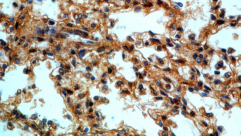 Immunohistochemical of paraffin-embedded human lung using Catalog No:109649(CXorf22 antibody) at dilution of 1:50 (under 40x lens)