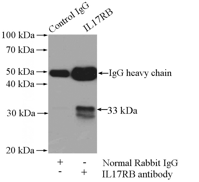 IP Result of anti-IL17RB (IP:Catalog No:111765, 4ug; Detection:Catalog No:111765 1:300) with PC-3 cells lysate 900ug.