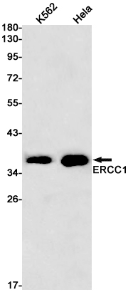 Western blot detection of ERCC1 in K562,Hela cell lysates using ERCC1 Rabbit pAb(1:1000 diluted).Predicted band size:33kDa.Observed band size:39kDa.